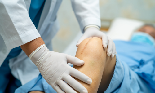 Robotic Knee Replacement