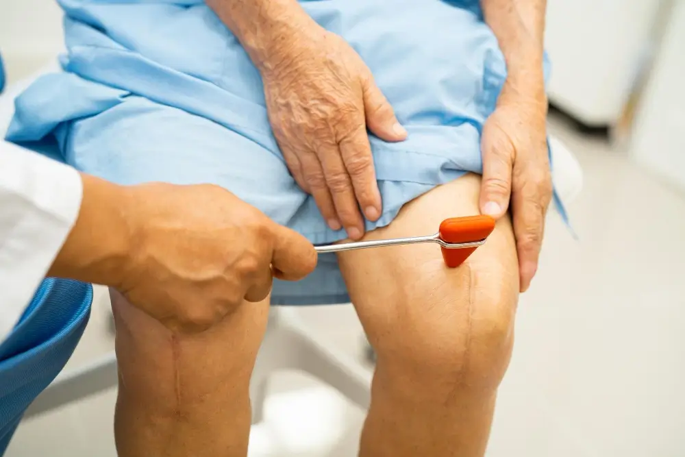Illustration explaining revision knee replacement surgery for replacing a failed knee implant