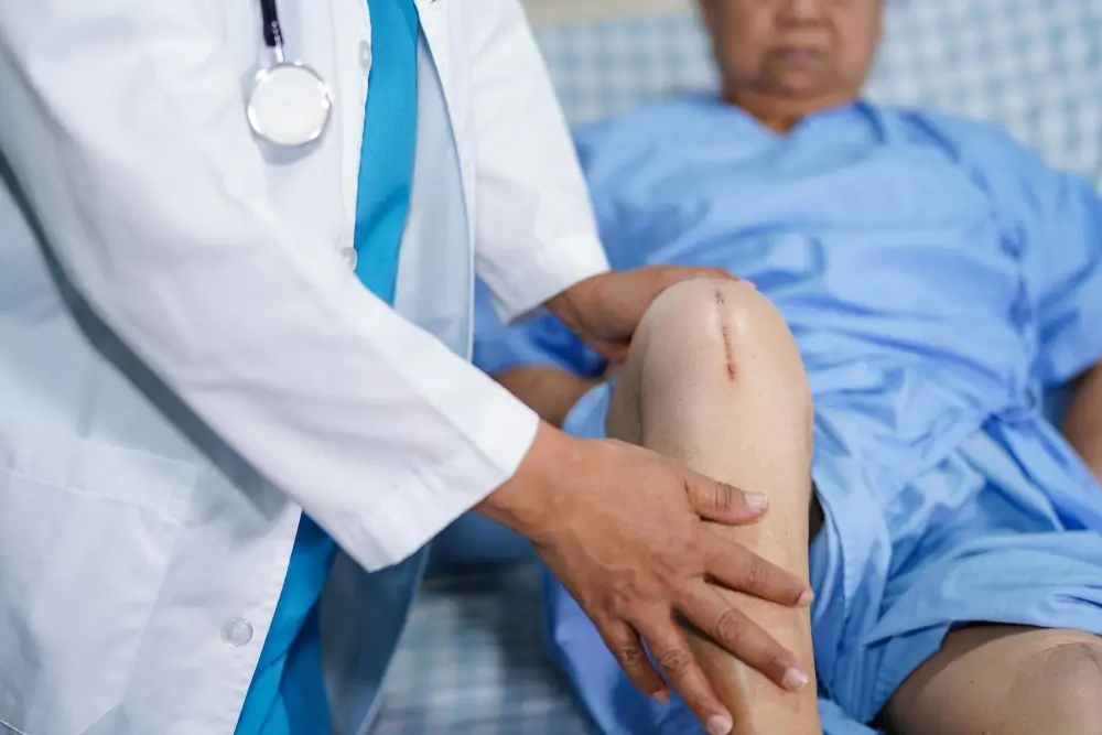 Medical illustration showing partial knee replacement surgery for arthritis affecting one compartment of the knee.
