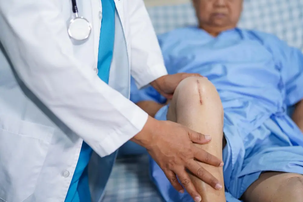 Illustration showing unicondylar partial knee replacement surgery where only the damaged portion of the knee joint is replaced