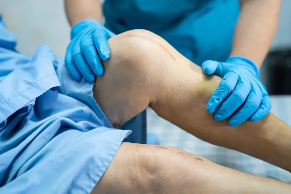 Patient recovering after robotic joint replacement surgery under the care of Dr Sanjeev Jain