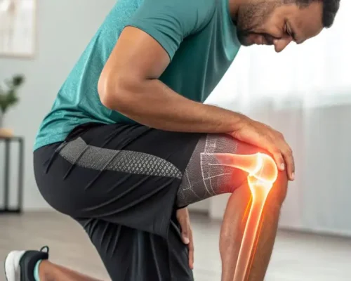Revision Knee Replacement Surgery | Dr Sanjeev Jain