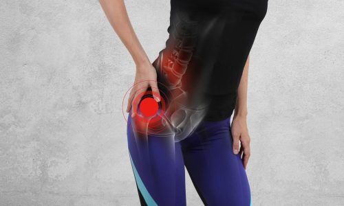 hip replacement new